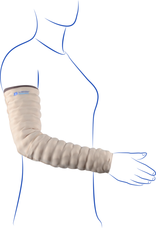 MOBIDERM Standard Armsleeve - Image 2